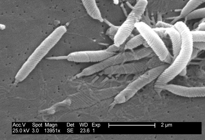Industrial Monitor - Le premier écran tactile antimicrobien de Corning affiche un gros plan d’un groupe de bactéries
